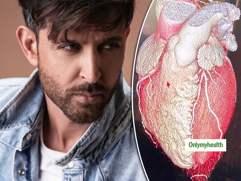 Heart Care: Hrithik Roshan Puts A Picture of His Heart, Shares A Note To Remember
